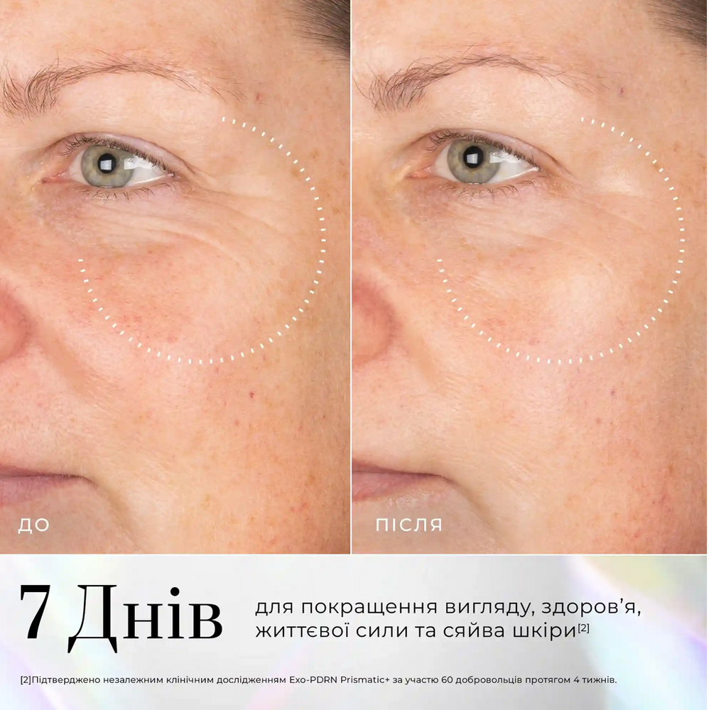EXO-PDRN PRISMATIC+ MEDIK8 ARCSZ&Eacute;RUM MEG&Uacute;J&Iacute;T&Aacute;S&Eacute;RT &Eacute;S FIATAL&Iacute;T&Aacute;S&Eacute;RT exo-pdr фото