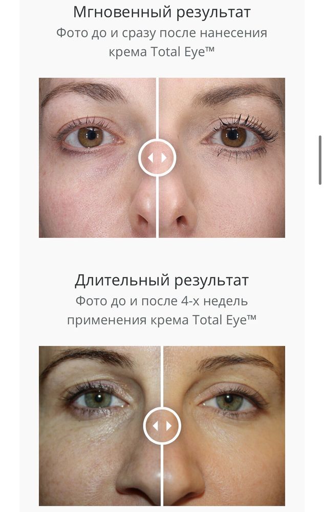 Total EyeTM 3-in-1 | Eye Cream SPF 35